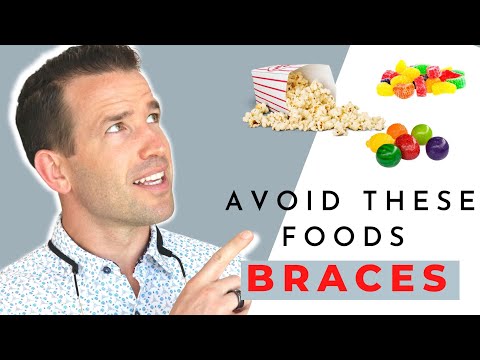 Braces: What foods should you avoid?