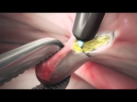 Understanding Jet Plasma: A Comprehensive Overview