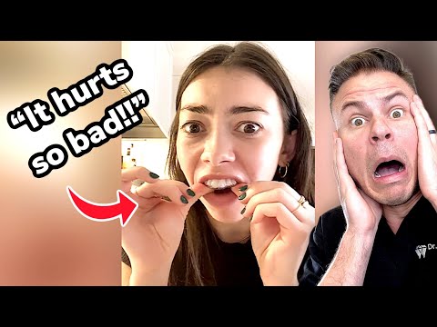 Steps to Take When Misplacing Your Retainer
