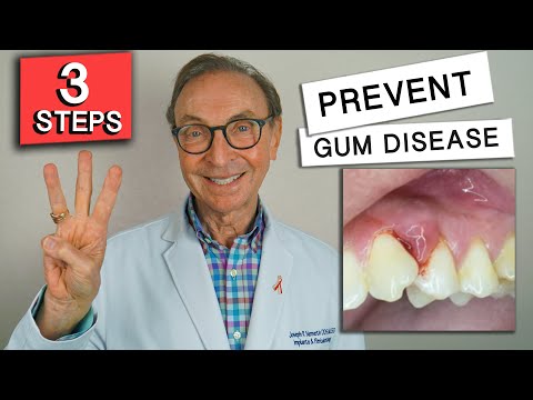 Understanding Gum Therapy