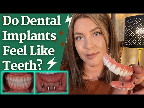 What is the appearance of dental implants?