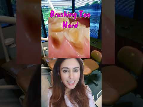 What Causes Tooth Discoloration?