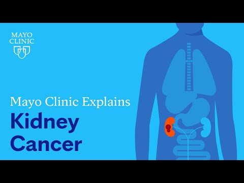 Understanding Kidney Cancer